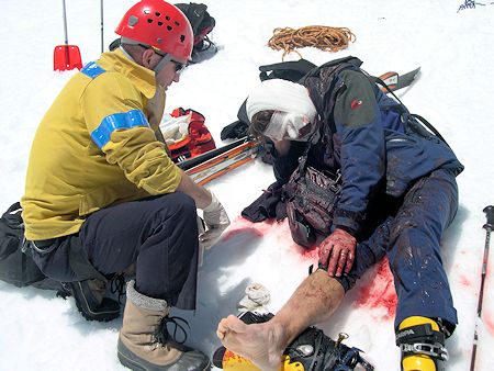Victim's injuries included a possible broken leg - DM Photo Victim's injuries included a possible broken leg - DM Photo